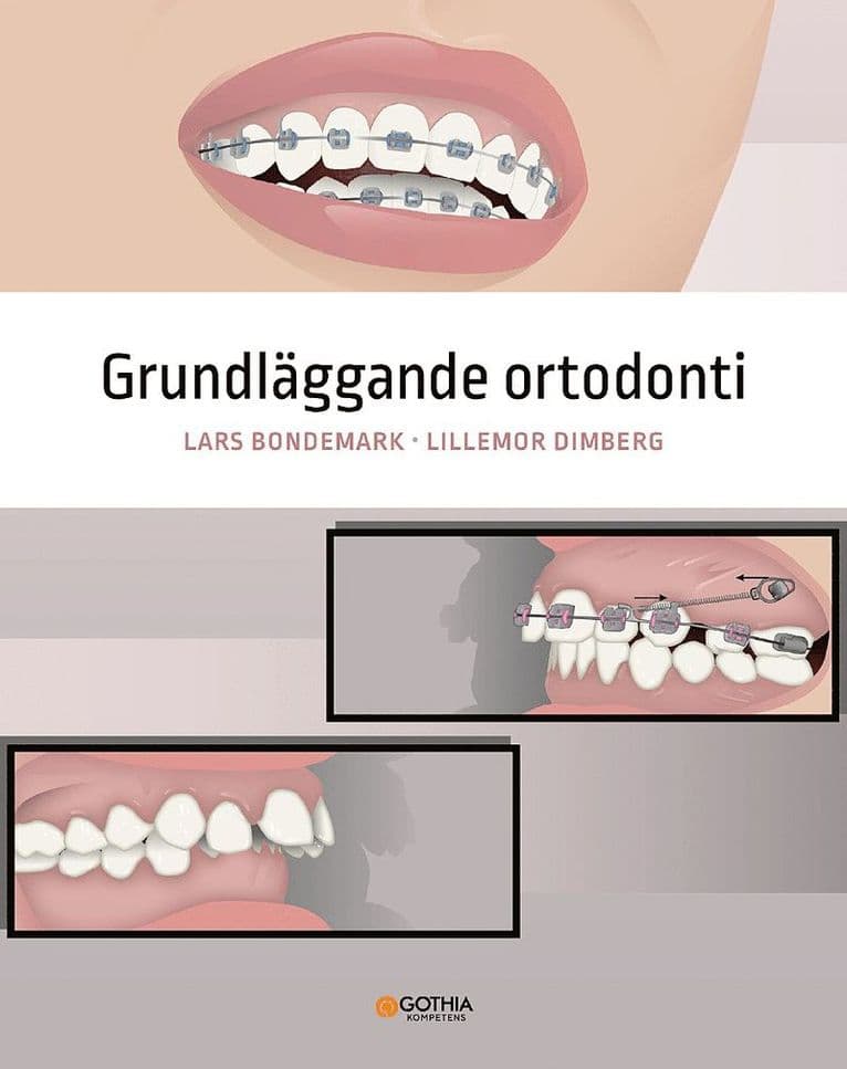 Grundläggande ortodonti