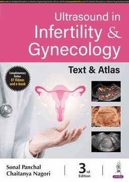 Ultrasound in Infertility & Gynecology