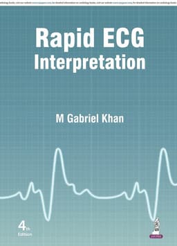 Rapid ECG Interpretation