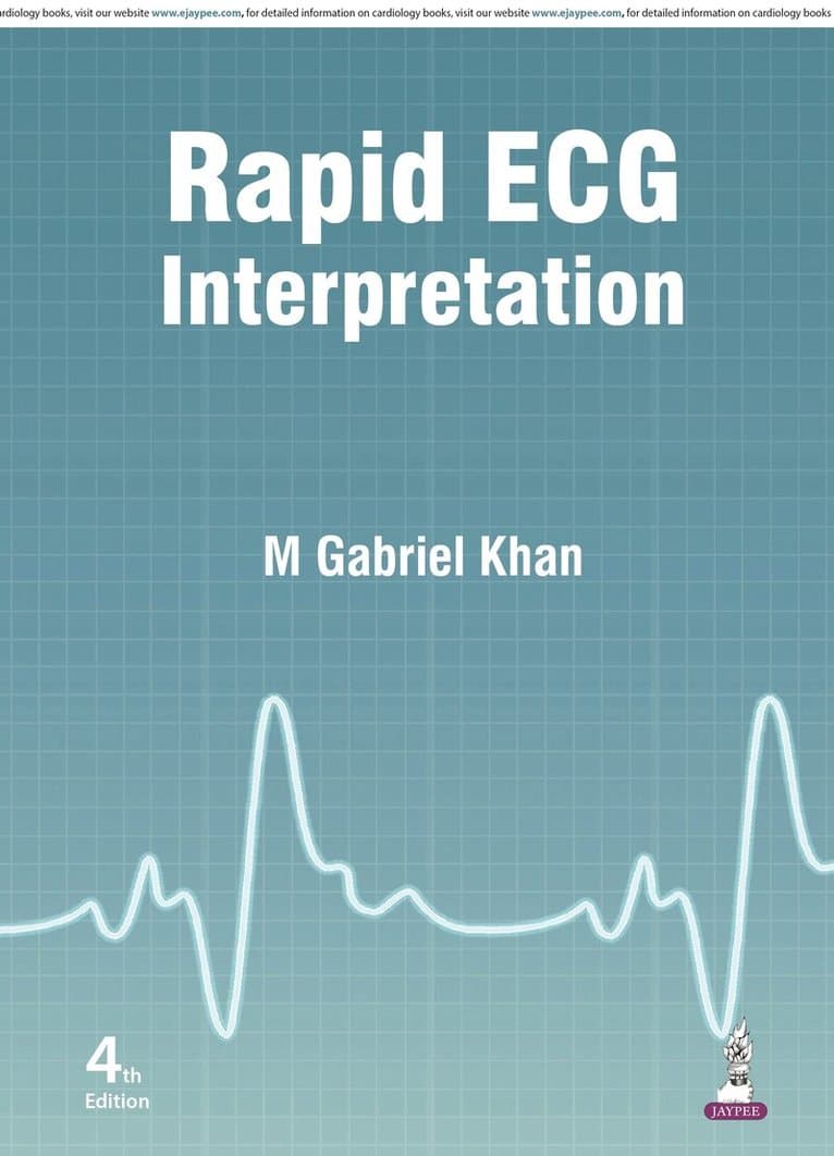 Rapid ECG Interpretation