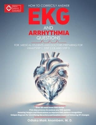 How to Correctly Answer EKG and Arrhythmia Questions