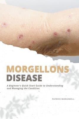 Morgellons Disease