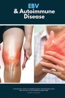 EBV & Autoimmune Disease