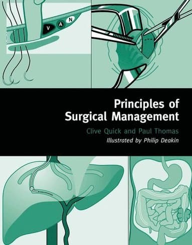 Principles of Surgical Management