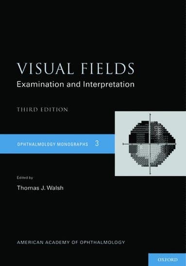 Visual Fields