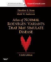 Atlas of Normal Roentgen Variants That May Simulate Disease