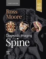 Diagnostic Imaging: Spine