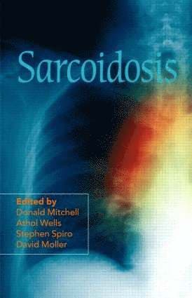 Sarcoidosis