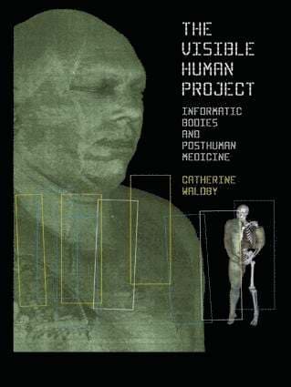 Visible Human Project