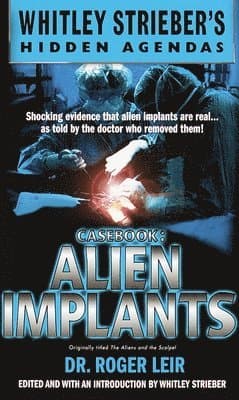 Casebook: Alien Implants