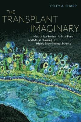 Transplant Imaginary
