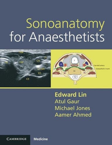 Sonoanatomy for Anaesthetists