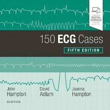 Omslag till boken 150 ECG Cases av John Hampton