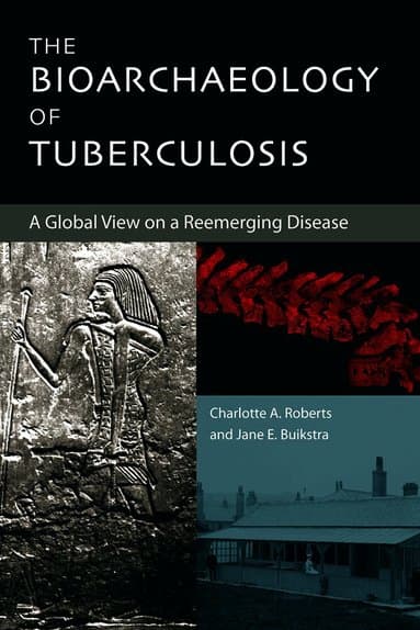 Bioarchaeology of Tuberculosis