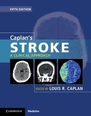 Caplan's Stroke