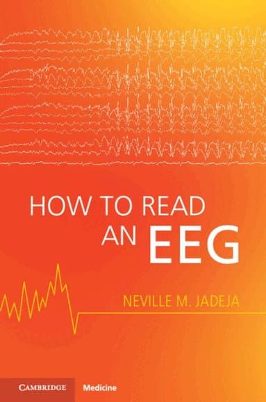 How to Read an EEG