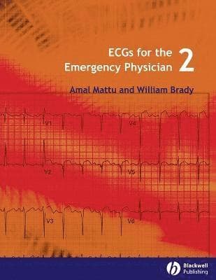 ECGs for the Emergency Physician 2
