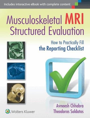 Omslag till boken Musculoskeletal MRI Structured Evaluation av Avneesh Chhabra