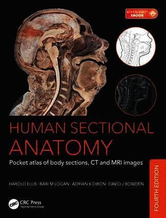 Human Sectional Anatomy
