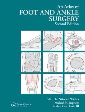 Atlas Foot and Ankle Surgery