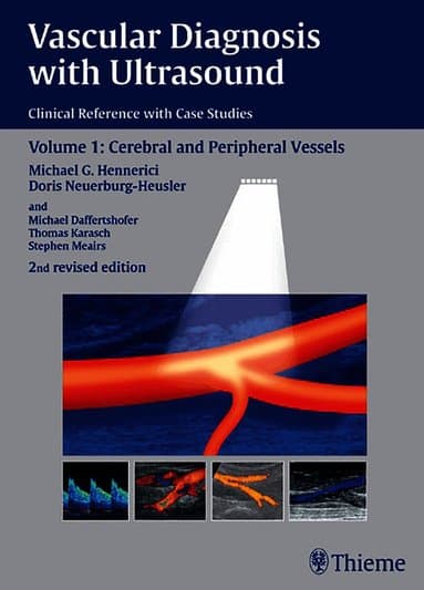 Vascular Diagnosis with Ultrasound