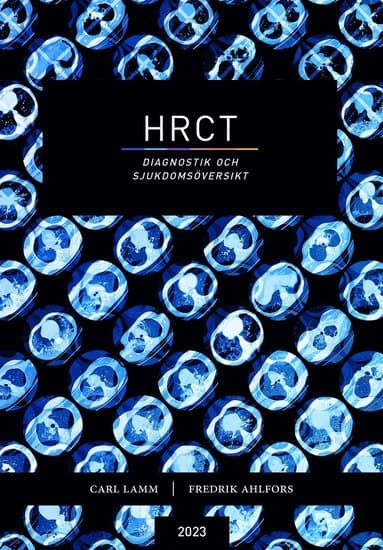 HRCT : diagnostik och sjukdomsöversikt